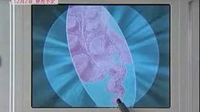 LifeSigns: Surgical Unit Nintendo DS Gameplay_2004_11_05 смотреть онлайн