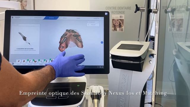 NEXUS IOS @christophe niviere @paltopdental452 @osteonmedical @nexusios_dental @ChristopheNiviere смотреть онлайн