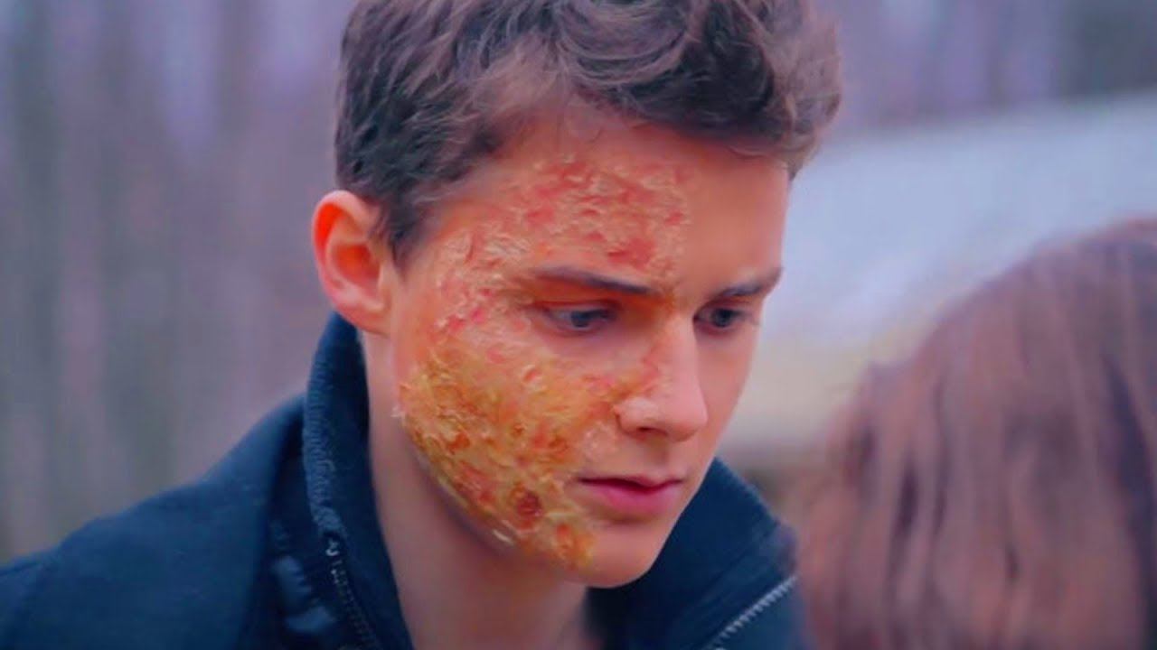 ЭТОГО ПАРНЯ НЕНАВИДИТ ВЕСЬ МИР ИЗ-ЗА ЕГО ВНЕШНОСТИ! смотреть онлайн