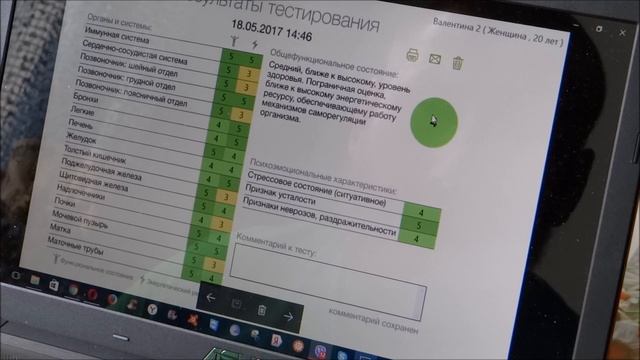 РОФЭС обзор ROFES TEST Обман!!! Развод на диагностику РОФЕС!!! смотреть онлайн