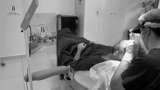 Результат пересадки волос в Bellus Clinic смотреть онлайн