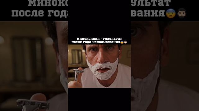С мезороллером?🦔 #кино#film#фильмы#movie#борода#миноксидил смотреть онлайн