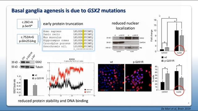 Agenesis of the putamen and globus pallidus caused by recessive mutations in the homeobox gene GSX2 смотреть онлайн