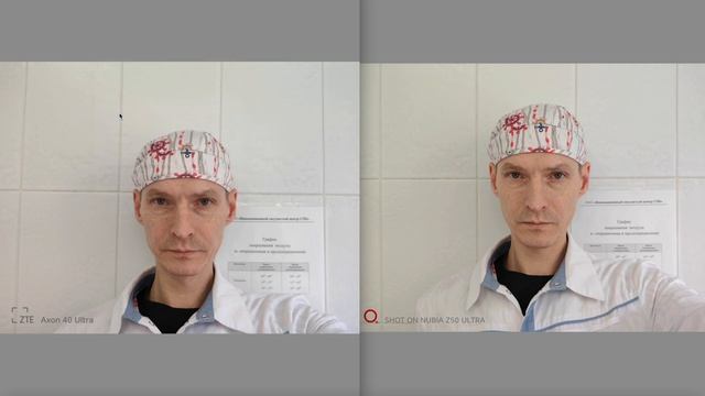 NUBIA Z50 ULTRA vs AXON 40 ULTRA смотреть онлайн