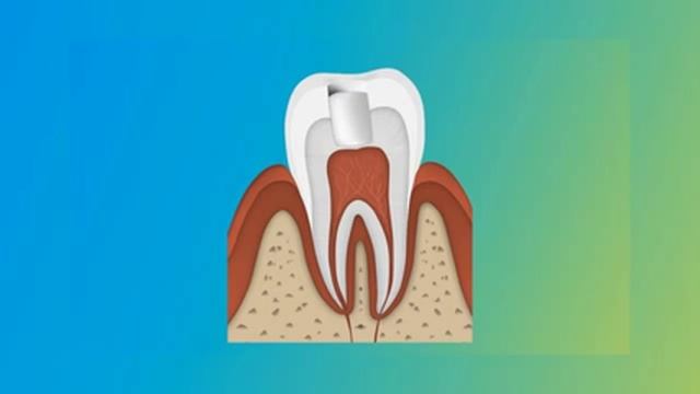 Зачем менять пломбы если зуб не беспокоит смотреть онлайн
