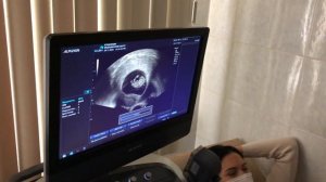 Беременность на 9 недельке