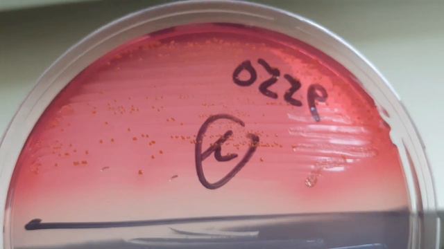 Enterococcus faecium Colony characteristics on CLED agar смотреть онлайн