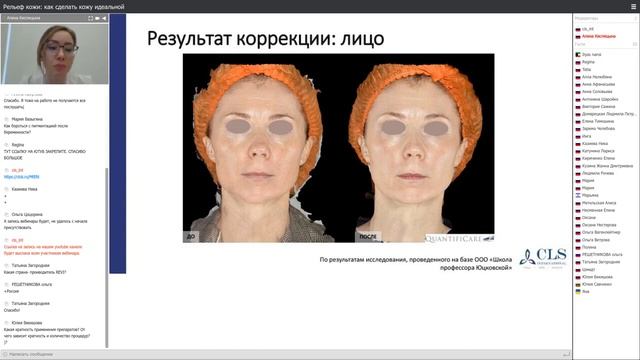 Рельеф кожи  как сделать кожу идеальной