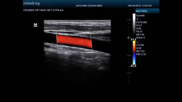 Mindray DP-50 - примеры исследований. смотреть онлайн
