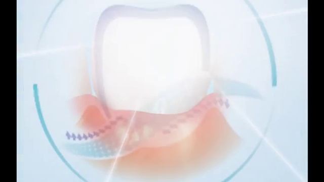 Асепта видео о серии