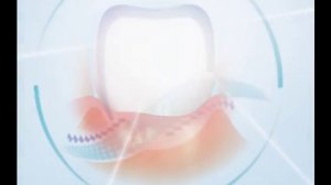 Асепта видео о серии