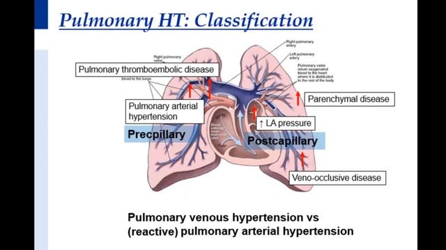 RV function and pulmonary hypertension смотреть онлайн