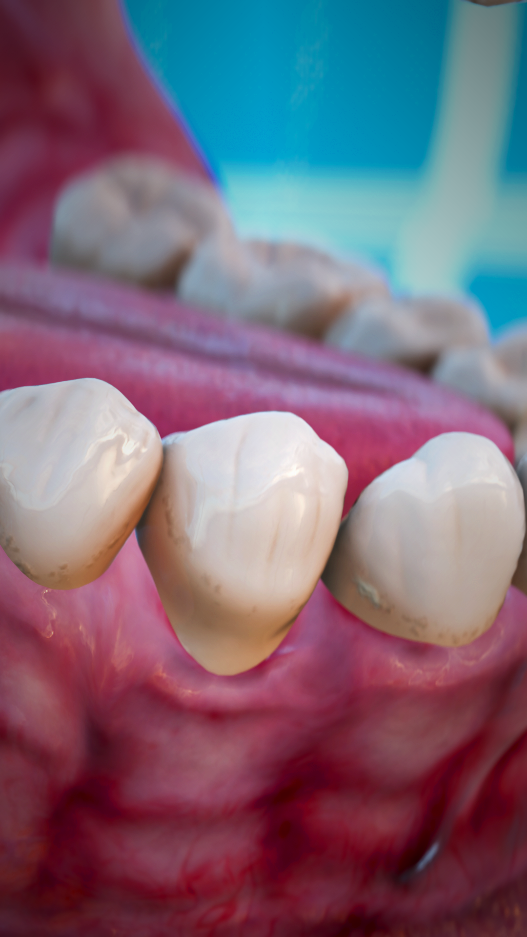 Как исправляют проблемы с дёснами 🤔