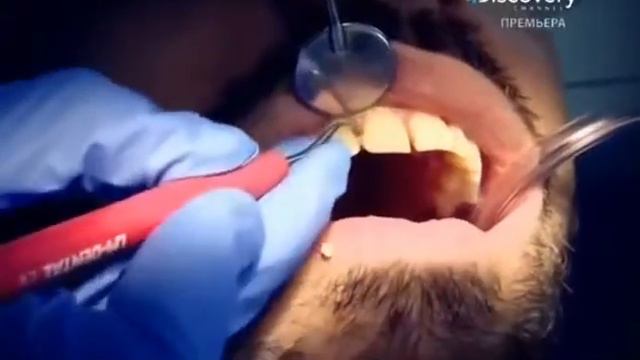 Откуда Странный Запах с Рта ! Жесть смотреть онлайн