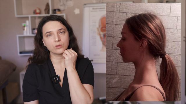 Шея и отечность лица. Какая связь? Разбор по фото. смотреть онлайн