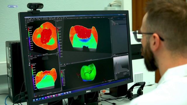 Новое исследование ученых ДГТУ в области лечения поверхностного кариеса методом инфильтрации
