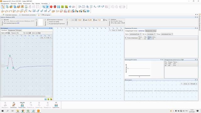 «Лайтбокс» — трехканальный электронейромиограф с функцией исследования вызванных потенциалов мозга