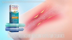 Риномарис Адванс