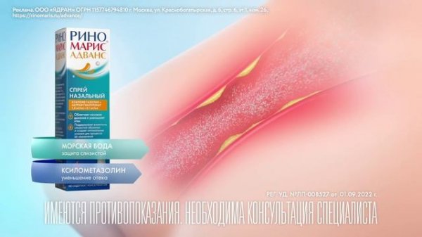 Риномарис Адванс