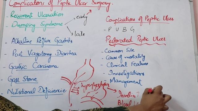 GIT SURGERY lecture 13 COMPLICATIONS of Surgery of peptic Ulcer, Dumping syndrome, Rox en Y procedu смотреть онлайн