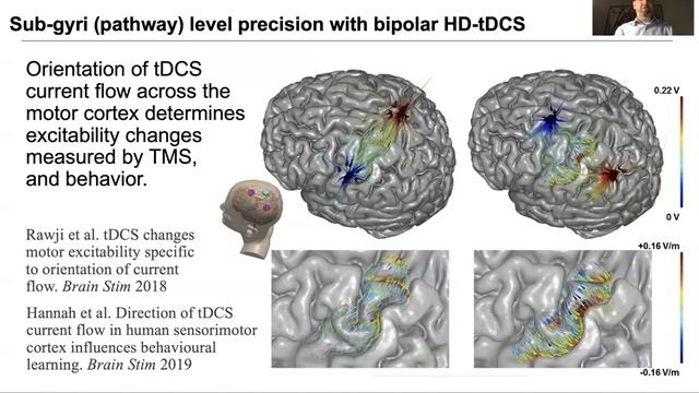 HD-tDCS: Low-power, Targeted, Non-invasive Electroceuticals for CNS diseases смотреть онлайн