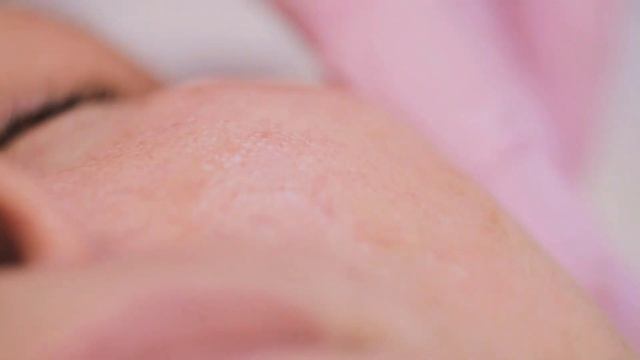 Фотоомоложение лица (процедура, до и после) смотреть онлайн