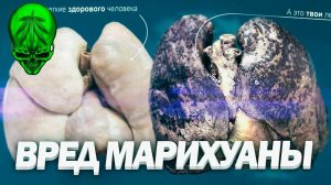 МАРИХАУАНА ВРЕД ИЛИ НЕТ? Вред Курения Марихуаны. Факты о марихуане