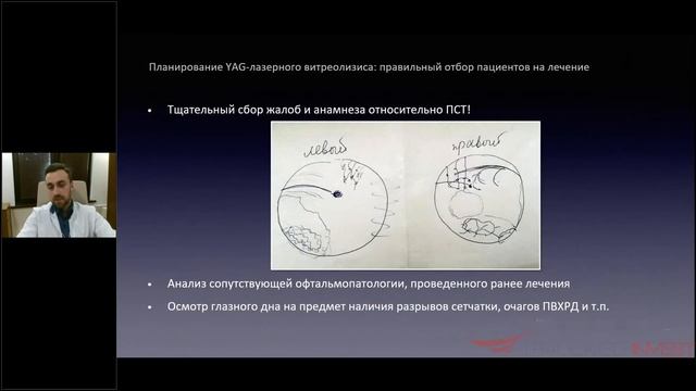 Лазерный витреолизис в борьбе за качество зрения пациентов смотреть онлайн