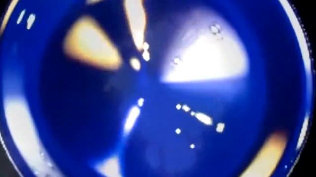 DEPAKINE смотреть онлайн