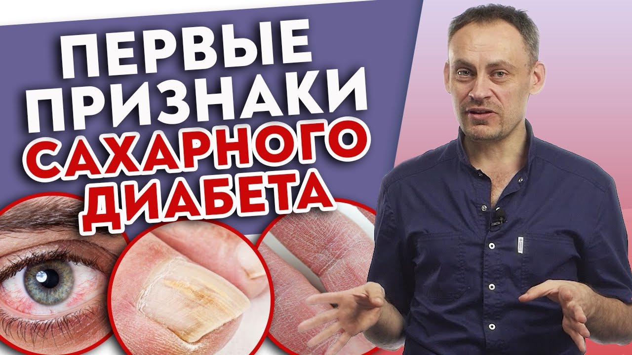 ТОП-9 первых признаков сахарного диабета. Что делать, если вы заболели диабетом? смотреть онлайн