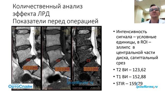 Доктор БОРЩЕНКО. Лазерная реконструкция и дискэктомия. Зачем лечить хрящ диска?! смотреть онлайн