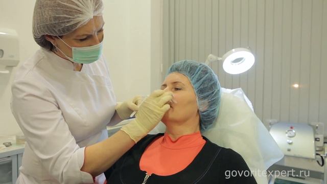 Устранение носогубных складок в клинике Медильер смотреть онлайн