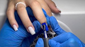Акригель или Полигель?