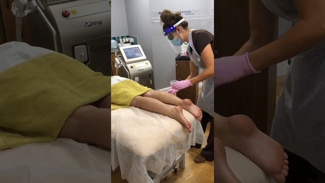 Soprano ICE Laser Hair Removal