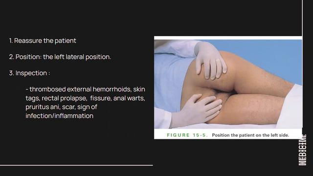 Scenario1 Academic Year 2022, July : Role Of Digital Rectal Examination In Acute Appendicitis