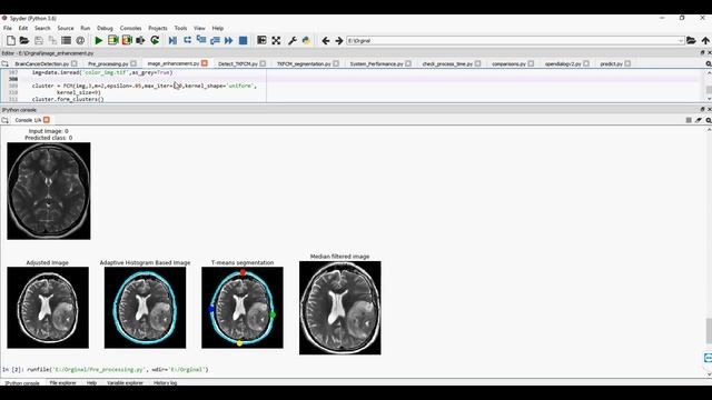 Latent Correlation Representation Learning for Brain Tumor Segmentation With Missing MRI Modalities смотреть онлайн