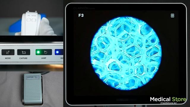 Эндоскопическая визуальная система Cham Vision Chammed Co,.LTD. обзор от Medical Store. смотреть онлайн