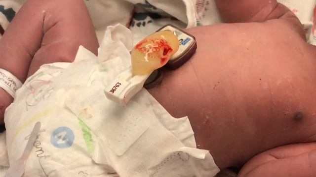 Birth Vlog / Labor And Delivery / C Section 37 Weeks Pregnant / Graphic