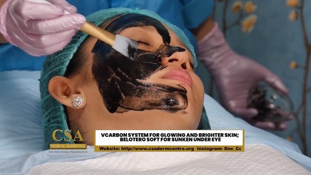 VCARBON SYSTEM FOR GLOWING AND BRIGHTER SKIN; BELOTERO SOFT FOR SUNKEN UNDER EYE смотреть онлайн