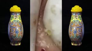 часть 24 : Удаление черных точек, полное видео от доктора Nana, Blackhead Removal