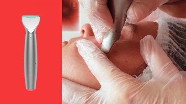 Dermia Solution - Treatment Video 2019.mp4