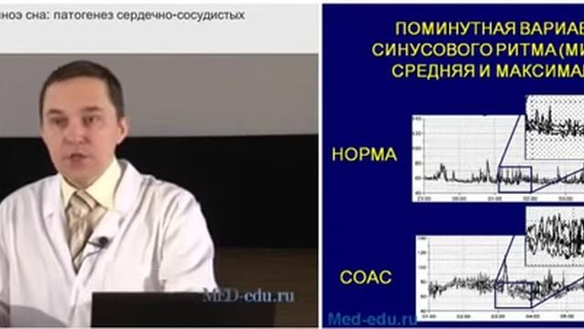 Синдром обструктивного апноэ сна. Патогенез сердечно-сосудистых осложнений. Р.В. Бузунов. Лекция 2 смотреть онлайн