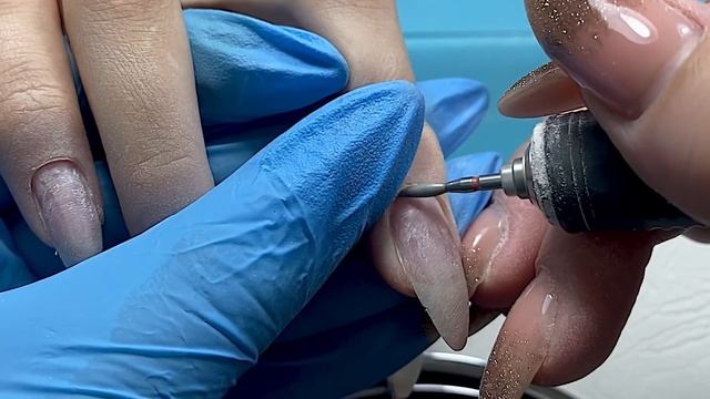 Цикличные отслойки, что делать? Грязные синусы| НЕ ПОКУПАЙТЕ ЭТОТ АППАРАТ? смотреть онлайн