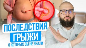 ПОСЛЕДСТВИЯ ПУПОЧНОЙ ГРЫЖИ о которых молчат доктора. Современные методы лечения пупочной грыжи