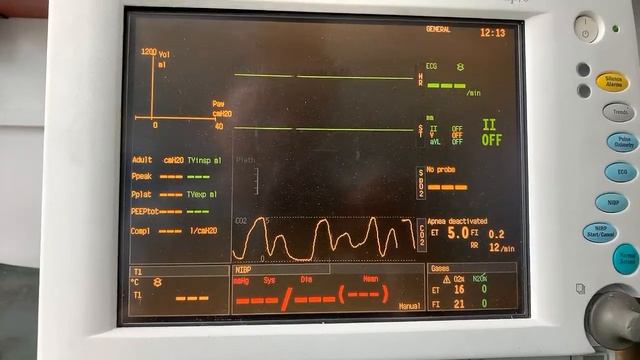 Mindray C5 Testing смотреть онлайн