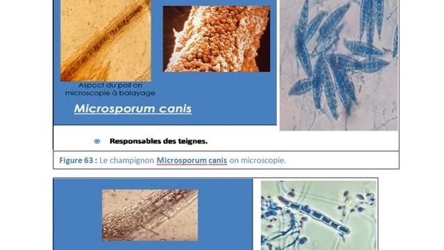 Les Ascomycota -Partie 5- Les Pezizomycotina1 Penicillium, Aspergillus, Paecilomyces, Les dermatop смотреть онлайн
