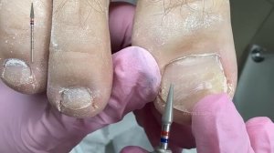 Мужской педикюр / Странный налет на ногтях /