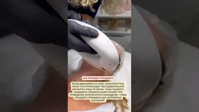фотоомоложение Краснодар смотреть онлайн