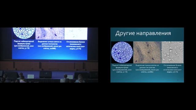 Обработка медицинских изображений. Андрей Созыкин, УрФУ смотреть онлайн