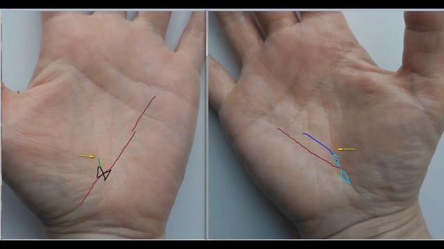 Онкология на руке. Анализ линий на ладони. смотреть онлайн
